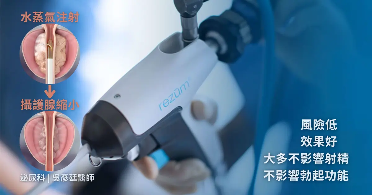 攝護腺肥大最新微創治療：水蒸氣消融手術